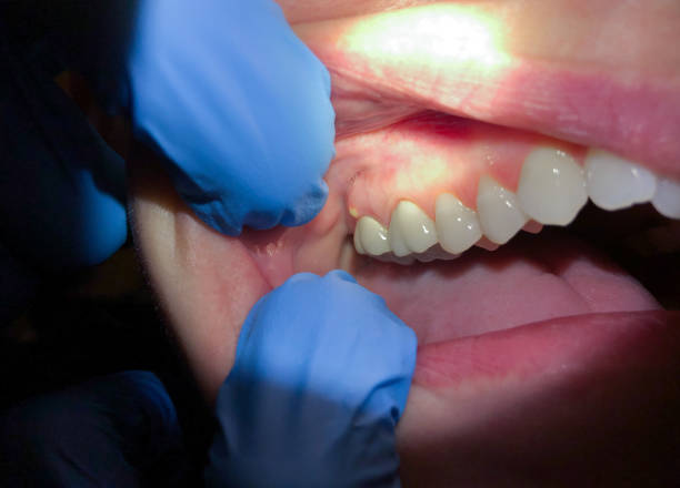 Best Emergency Orthodontic Services in White Pigeon, MI