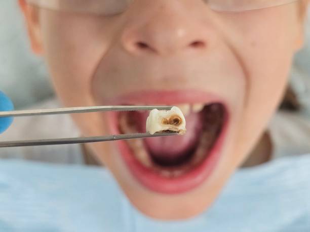 Best After-Hours Dental Trauma Care in White Pigeon, MI