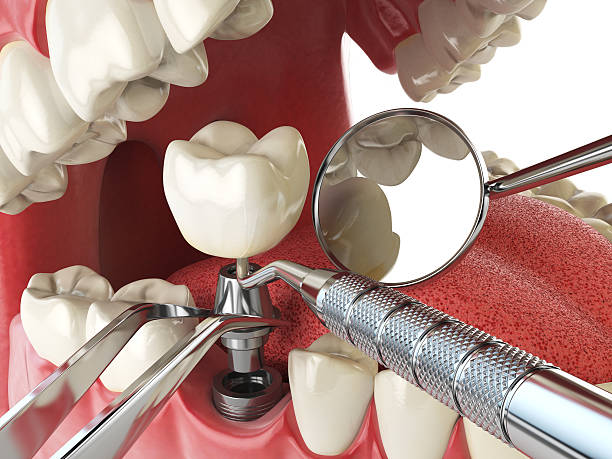 Best Weekend Emergency Dentist in White Pigeon, MI