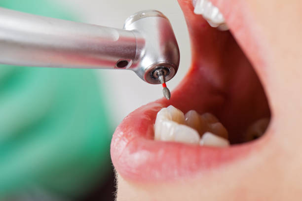 Best Cosmetic Emergency Dentistry in White Pigeon, MI